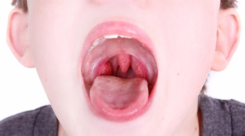 ss