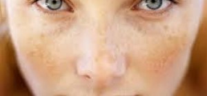 Bahar aylarında cildinize dikkat