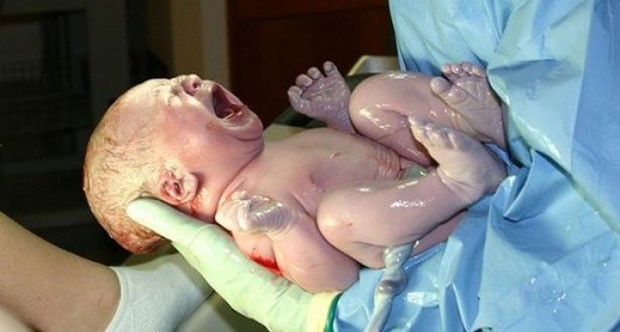 Bebekler Beyinleri Hasarlı Doğuyor