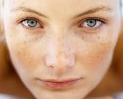 Bahar aylarında cildinize dikkat