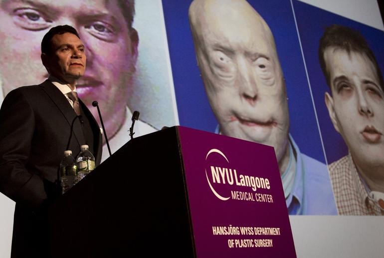 En Kapsamlı Yüz Naklini ABD Yaptı