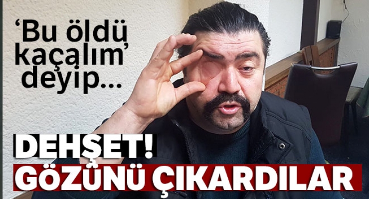 ÜSKÜDAR 'DA AKIL ALMAZ OLAY !