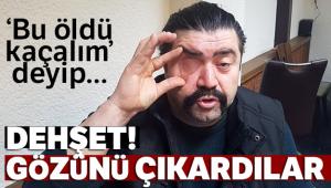 ÜSKÜDAR 'DA AKIL ALMAZ OLAY !